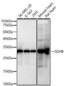 SDHB Monoclonal Antibody [6H7Z5]