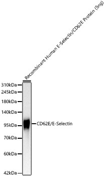 CD62E/E-Selectin Monoclonal Antibody [7M2C5]