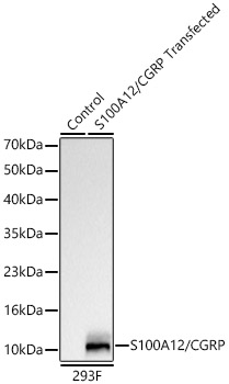 S100A12/CGRP Monoclonal Antibody [4A9D7]
