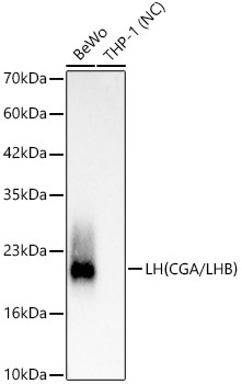LH(CGA/LHB) Monoclonal Antibody [9N4G9]
