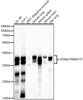 STING/TMEM173 Monoclonal Antibody