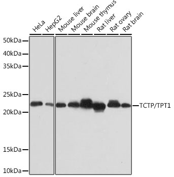 TCTP/TPT1 Monoclonal Antibody [9H7S4]