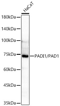 PADI1/PAD1 Monoclonal Antibody [8M9P3]
