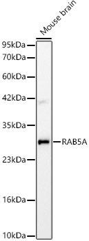 RAB5A Monoclonal Antibody [6M3K8]