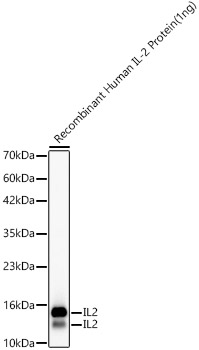 IL2 Monoclonal Antibody [5O2Y7]