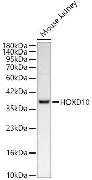HOXD10 Monoclonal Antibody [5H5S6]