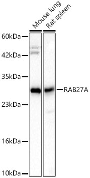 RAB27A Monoclonal Antibody [5Y0B0]