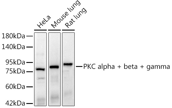 PKC alpha + beta + gamma Monoclonal Antibody [9O5J1]