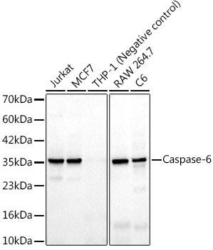Caspase-6 Monoclonal Antibody [6F6J5]