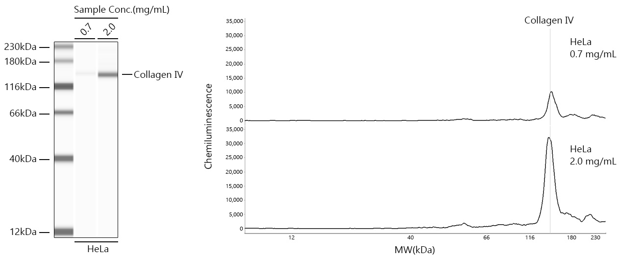 Collagen IV Monoclonal Antibody [3V3N3]