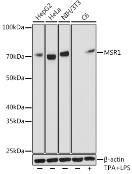 MSR1 Monoclonal Antibody [10O8B0]