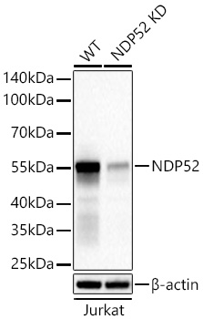 NDP52 Monoclonal Antibody [1T2S5]
