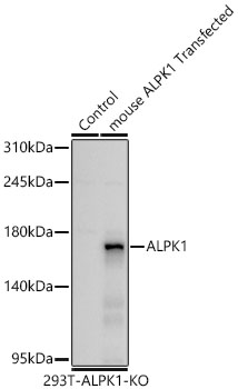 ALPK1 Monoclonal Antibody [5L8J4]