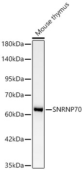 SNRNP70 Monoclonal Antibody [2W1C8]