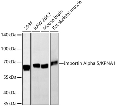 Importin Alpha 5/KPNA1 Monoclonal Antibody [5X8S3]