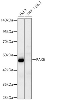 PAX6 Monoclonal Antibody [6W4C1]