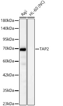TAP2 Monoclonal Antibody [2I2L1]