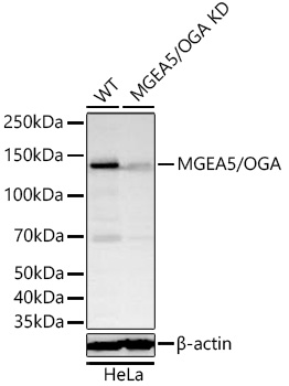 MGEA5/OGA Monoclonal Antibody [1H6E3]