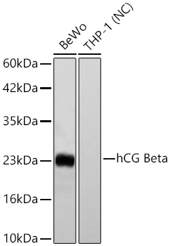 hCG Beta Monoclonal Antibody [3A9L9]