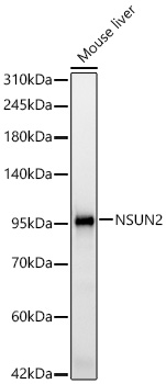 NSUN2 Monoclonal Antibody [7C4H6]