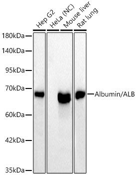 Albumin/ALB Monoclonal Antibody [7U4J8]