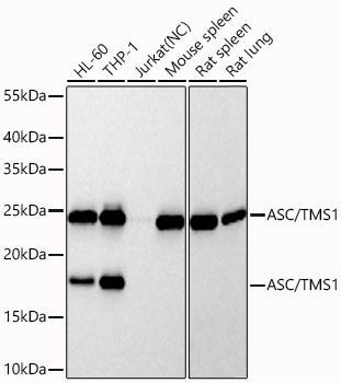ASC/TMS1 Monoclonal Antibody [1D5G9]