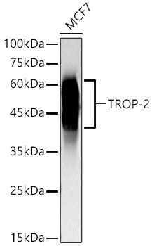 TROP-2 Monoclonal Antibody