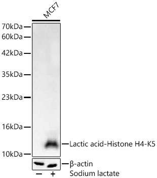 Lactic acid-Histone H4-K5 Monoclonal Antibody [9C9S7]