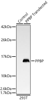 PPBP Monoclonal Antibody [2O7H5]