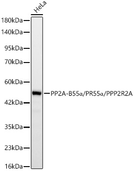 PP2A-B55a/PR55a/PPP2R2A Monoclonal Antibody [9E5N2]