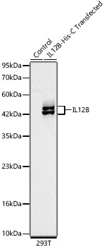 IL12B Monoclonal Antibody [3J8O0]