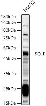 SQLE Polyclonal Antibody
