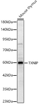 TXNIP Polyclonal Antibody