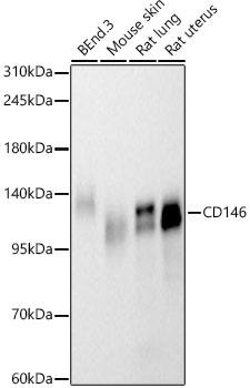 CD146 Monoclonal Antibody [0P2K3]