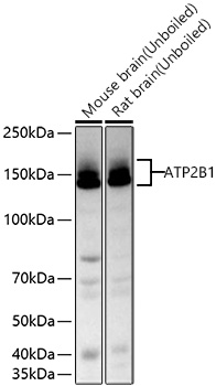 ATP2B1 Monoclonal Antibody [4J0R4]