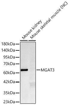 MGAT3 Monoclonal Antibody [4R7E2]