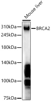 BRCA2 Polyclonal Antibody