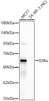 ESRa Monoclonal Antibody [1Z6L4]