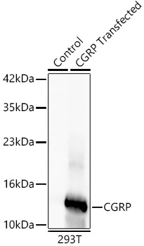 CGRP Monoclonal Antibody [10Y8B0]