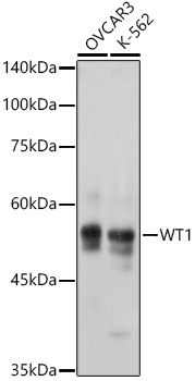 WT1 Monoclonal Antibody [6L9X6]