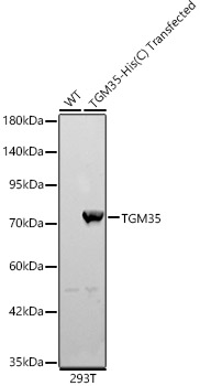 TGM3 Polyclonal Antibody