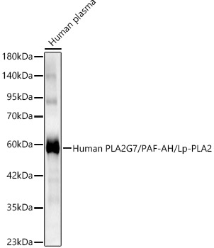 Human PLA2G7/PAF-AH/Lp-PLA2 Polyclonal Antibody