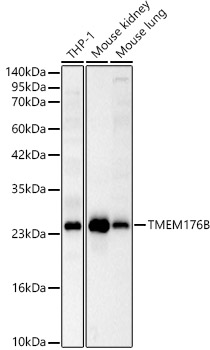TMEM176B Polyclonal Antibody