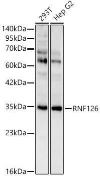 RNF126 Polyclonal Antibody