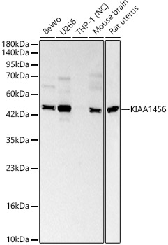 KIAA1456 Polyclonal Antibody