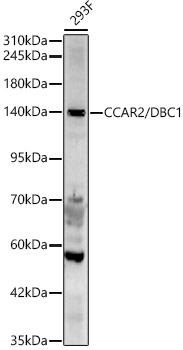 CCAR2/DBC1 Polyclonal Antibody