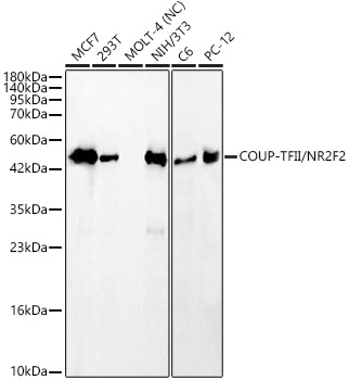 COUP-TFII/NR2F2 Monoclonal Antibody [8V6X2]