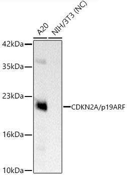 CDKN2A/p19ARF Monoclonal Antibody [0N7N4]