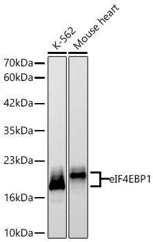 eIF4EBP1 Monoclonal Antibody [6X2L6]