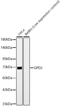 GPD2 Monoclonal Antibody [3C0Z7]